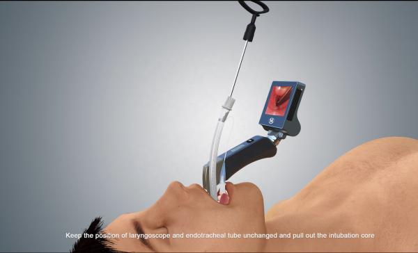 Reusable Blades Fiber Optic Mcgrath Video Laryngoscope ISO13485