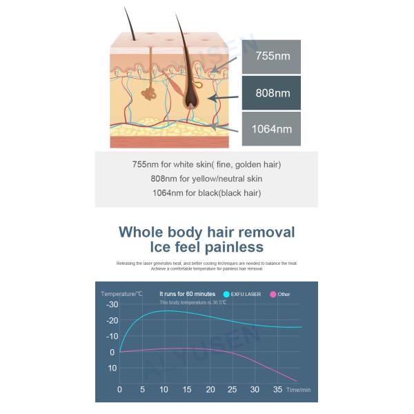 1000W Diode Laser Hair Removal Machine With Fast Hair Removal Function