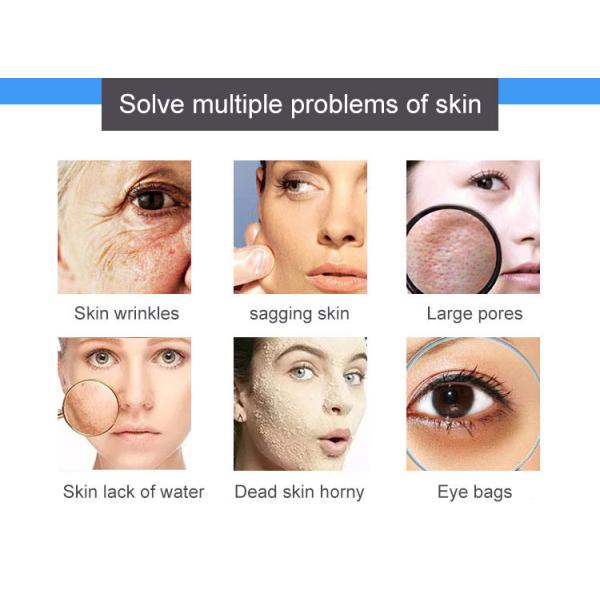 9 в 1 всесторонней машине красоты кожи управления для глубокой чистки