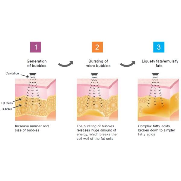 Ultrasound 4D Cavitation Slimming Machine Vacuum Body Cellulite Removal