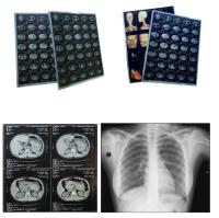 A4 Size Sheets Blue Inkjet Medical Film For Medical Image