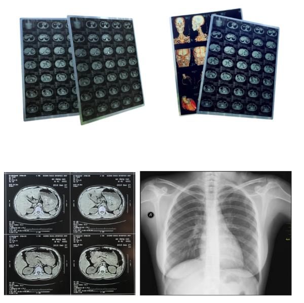 A4 Size Sheets Blue Inkjet Medical Film For Medical Image