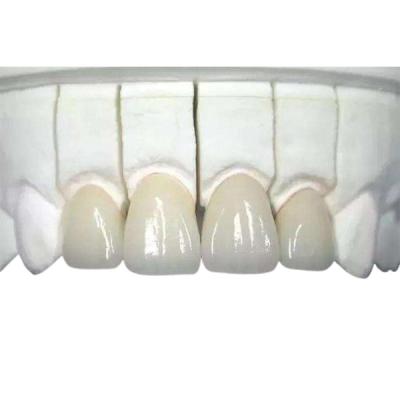 3D imprimiu o desgaste dental da coroa da zircônia - altamente Biocompatible resistente