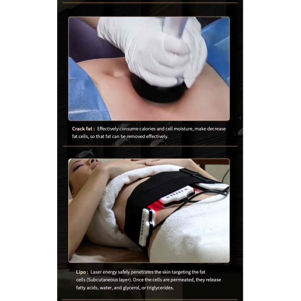40K Cavitation Slimming Machine , RF Vacuum Lipo Laser Machine For Body Shaping