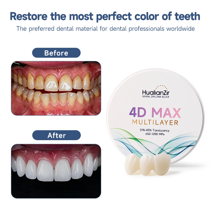 Denture Material CAD CAM Zirconia Block Multilayer Custom Logo 51% Transparency
