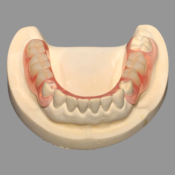 Dental Lab Crown |  Casting Pink TCS Flexible Partials With Excellent Retention