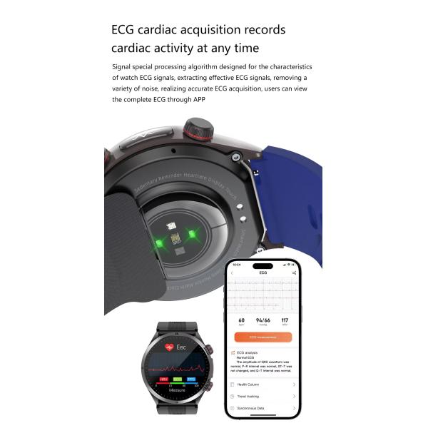 S26 Smart Watch 1.43 Inch AMOLED BT Calling Air Pump Blood Pressure Monitor SmartWatch