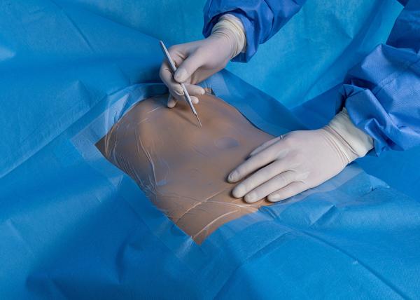 Produtos Médicos Embalagens Cirúrgicas EO Personalizadas Tecido não tecido
