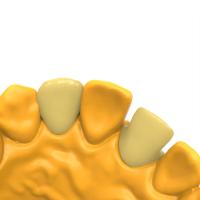Biocompatible Permanent Crown Bridge Résine de déformation à chaud Température 80C Résistance à la flexion 180-208 Mpa