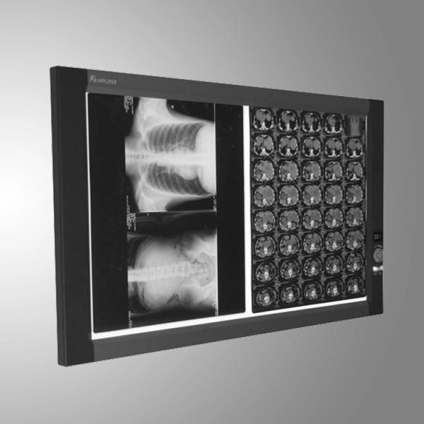 Hot Sale Manufacturer Supply LED Medical X-ray Film Viewer