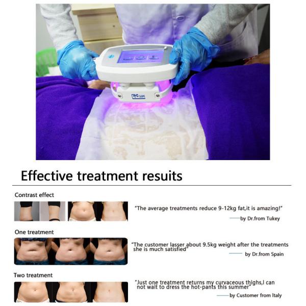 6 Handles 40khz Ultrasonic Cavitation RF Cryolipolysis Slimming Machine