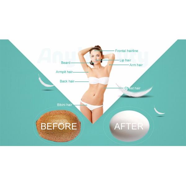 Painless 808nm Diode Laser Hair Removal Machine Medical Laser Equipment