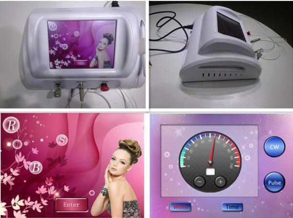 New Technology Rbs Vascular Removal / Spider Veins Removal Rbs Vascular