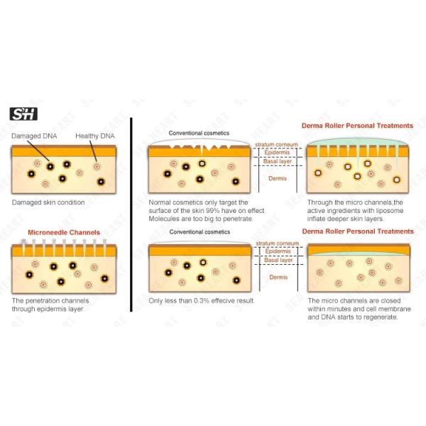 Медицинский уровень микроигла ролик дерма ролик антивозрастная уход за кожей красота мышь