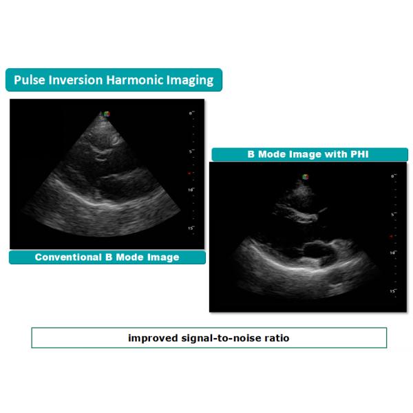 Trolley 4d Color Doppler Ultrasound Ecografo Sonoscape S50 Ultrasound