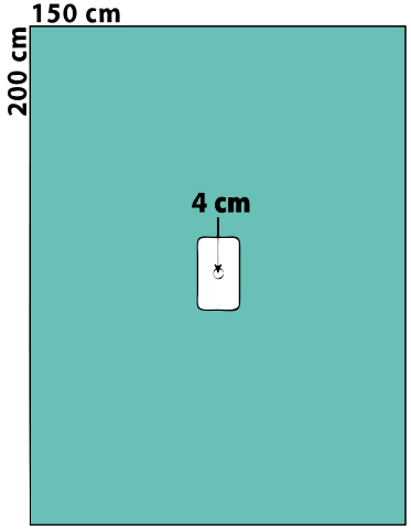 Quirúrgico disponible material de la extremidad superior de los PP SMS cubre con los tenedores del tubo