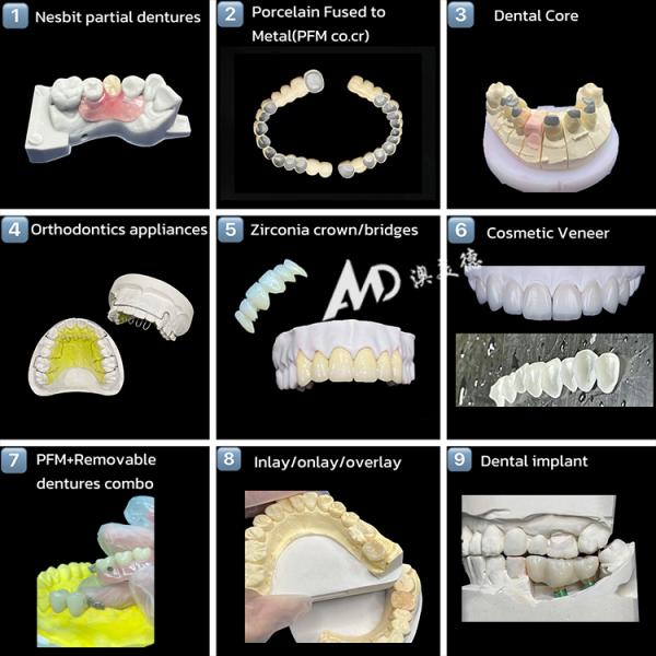 PMMA Puente de implante provisional hueco en el interior que garantiza la estabilidad y la curación natural