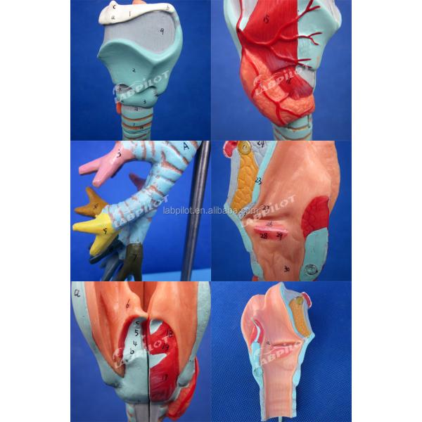 Medical Science Display Detachable Bronchial Tree and Trachea Model for Larynx Anatomy