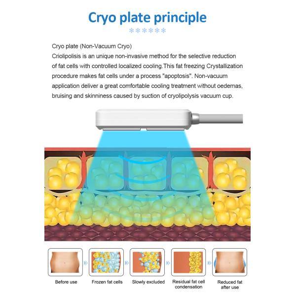 Зеленого света липолиза машины красоты сал лазера 6D красоты лазер 2022 Lipo неинвазивного холодный 532Nm для жирной потери