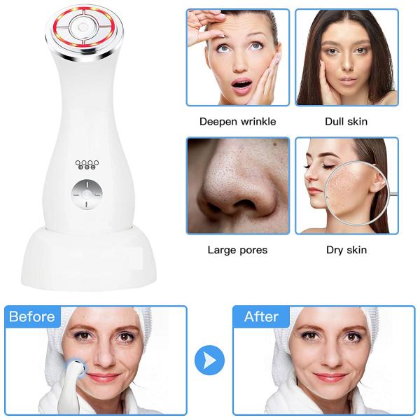 Acne Removal Rf Microcurrent Home Skin Tightening Device Skin Lifting Beauty Machine