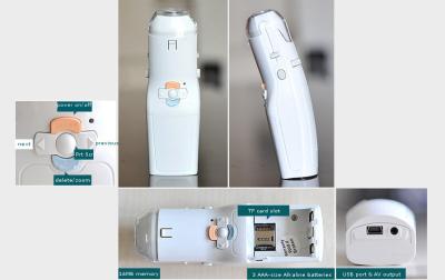 Auto - ferramenta da inspeção para a clínica individual aplicável e o hospital do Colposcope eletrônico de Digitas do exame cervical