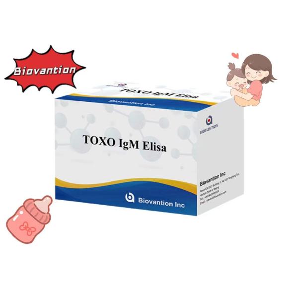 TOXO IgM ELISA Test Kit Torch High Sensitivity Hospital Test Pregnancy Check