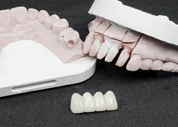 Premium Zirconia Dental Crowns for Superior Strength and Natural Aesthetics