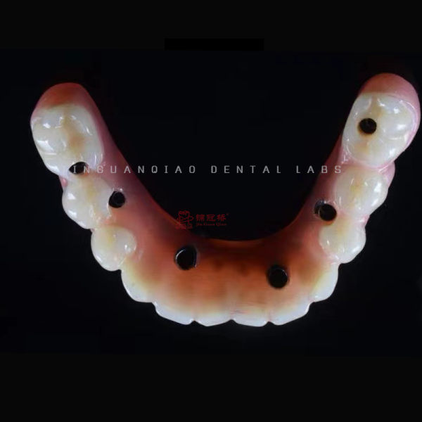 Multi Unit Abutment Titanium Alloy Zirconia Bridge Dental Implant Durable Prosthesis