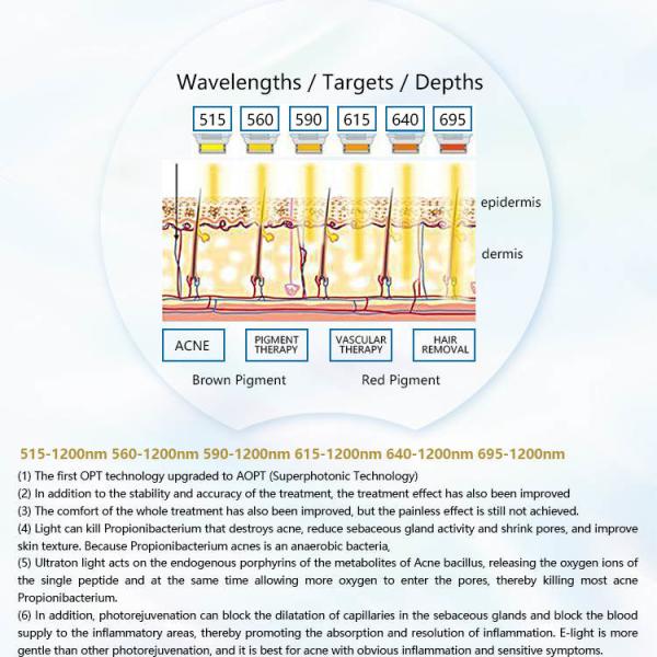 Прибор 1550 удаления волос лазера IPL