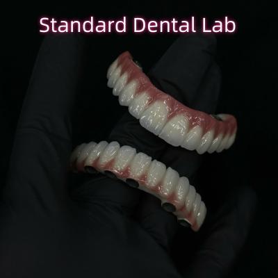 Titane et Zirconium Implantation pleine arche Meilleurs matériaux / techniciens 3-6 mois Temps de guérison