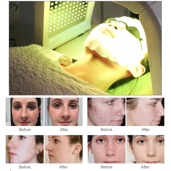 Professional Photodynamic Therapy Machine 200nm-900nm PDT Beauty Machine