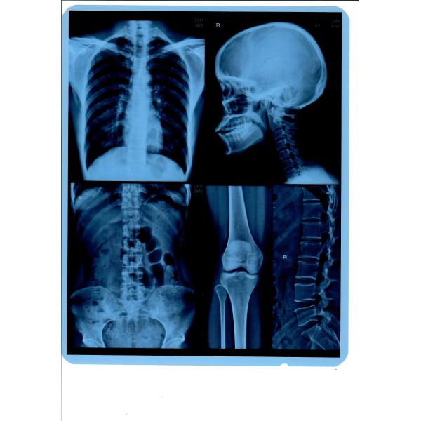 Долговечная рентгеновская пленка совместимая с принтерами Canon Epson