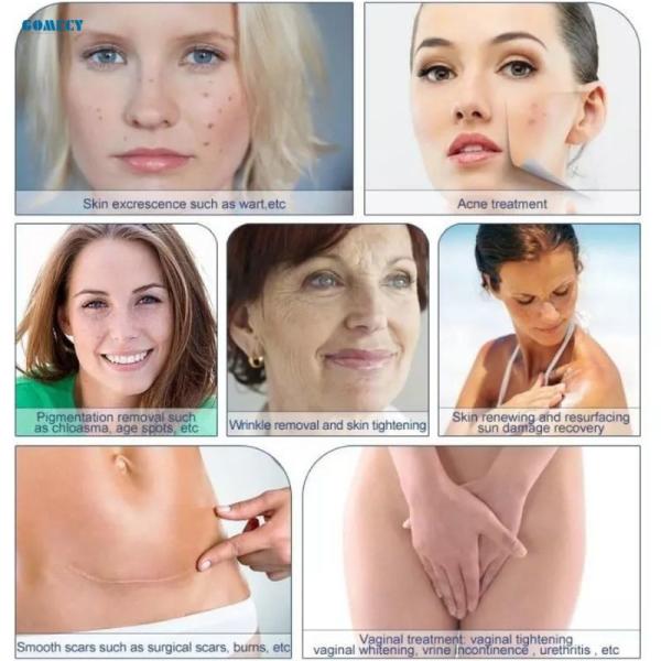 CO2 Fractional Laser Scar Removal Machine For Skin Repair Clinics With High Power Energy Output And Cooling System