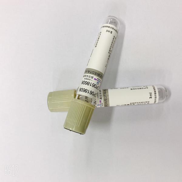 Устранимая больница трубки анализа крови используемая на допуске глюкозы