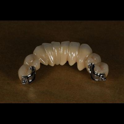Aesthetic Partial Denture Precision Attachments Medical Grade OEM