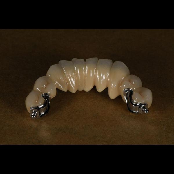 Aesthetic Partial Denture Precision Attachments Medical Grade OEM