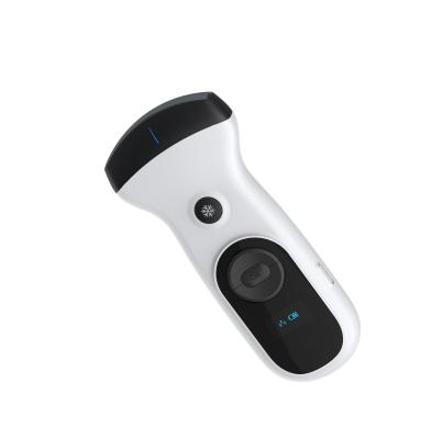 2025 Best Handheld Ultrasound | NMPA Approved with HD Frame Rate