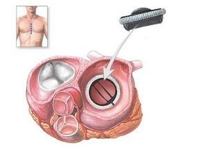 Customized Flexibility CE Graphite Parts For Biomedical