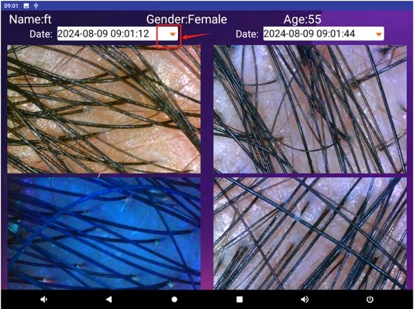 Máquina de prueba de cabello AI de escritorio HD de 15 pulgadas, analizador de cabello AI portátil para uso diario