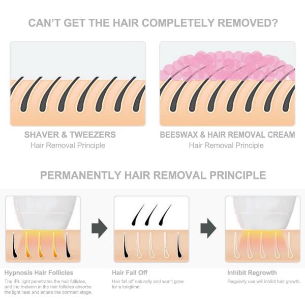 Super Hair Removal Machine ND YAG Laser Multifunction Beauty Machine Comfortable Treatment