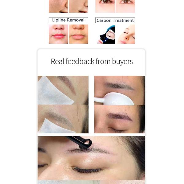 La peau Pico Carbon Facial Laser Machine tatouent le retrait 1064nm 532nm 1320nm