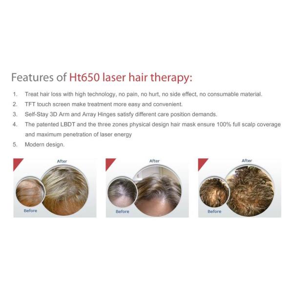 Прибор 650nm терапией диода машины Regrowth лазера волос красоты фотодинамический