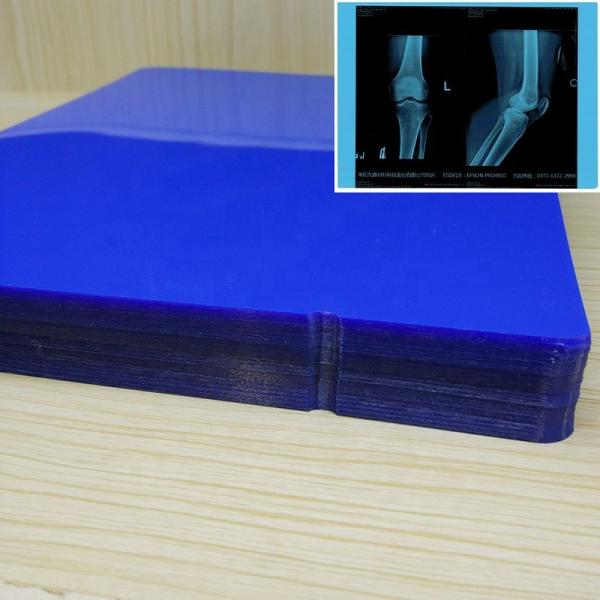 Фильм печати 11*14In голубого струйного фильма ISO9001 медицинский струйный