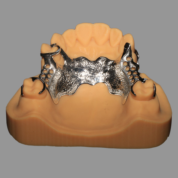 China Dental Lab | 3D Printed CoCr Metal Framework Partial Nickel Free Lightweight