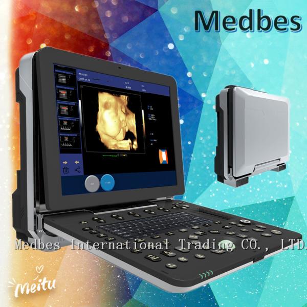 4D Portable Echocardiography Machine 2D Echo Color Digital Portable Ultrasound Scanner