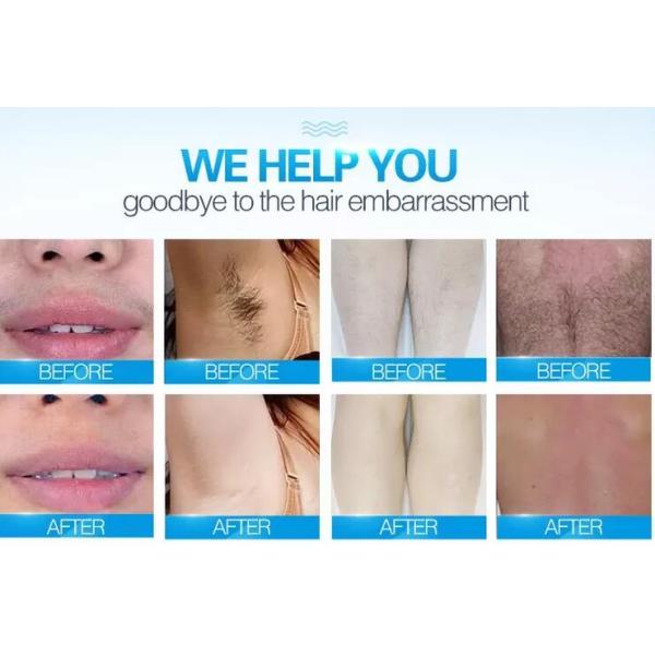 Portable Permanent Laser Hair Removal Machines For Beauty Salon / Home