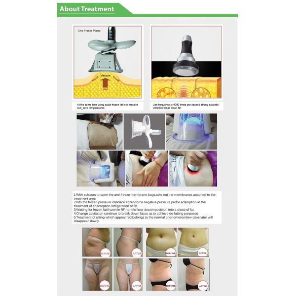6 в 1 машине Cryolipolysis жирной замерзая для жирного уменьшая 2200W