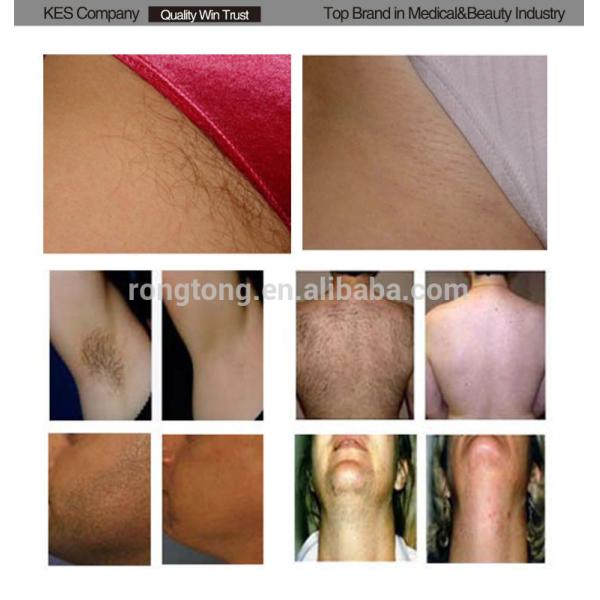 beauty spa equipment good result portable 12 month warranty IPL machine