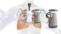 Nebulizador a frio de alta precisão para partículas de microtomo Tamanho ≤ 4,0 μm Capacidade 9-18 ml