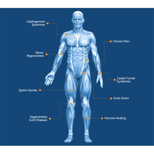 Спорт машины терапией магнето воздушного охлаждения 100-300 Кхз травмирует совместное облегчение боли Физио